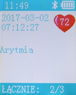 diagnoza-arytmia
